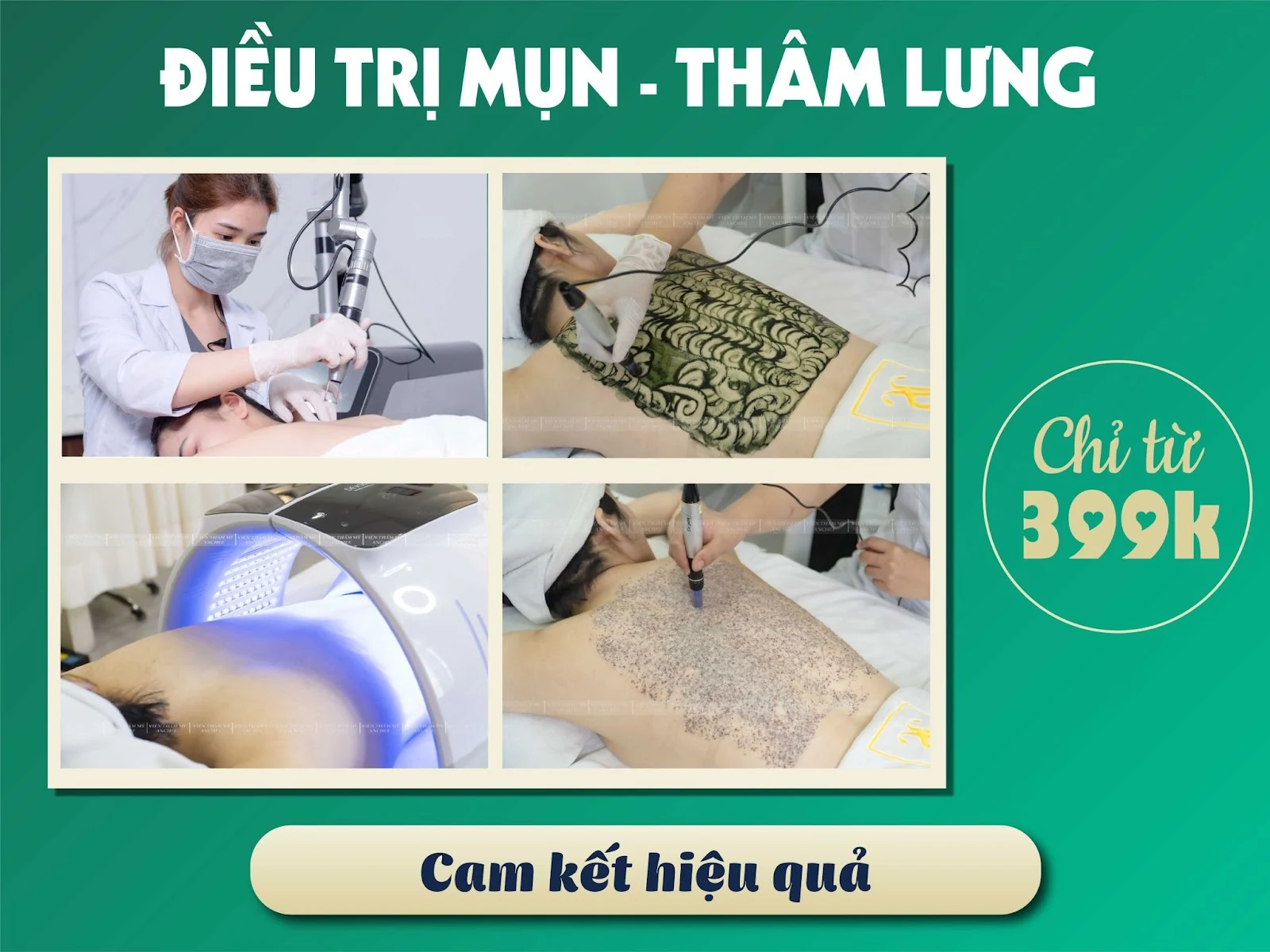 Bống Spa: Chia sẻ 4 cách trị mụn lưng tại nhà hiệu quả