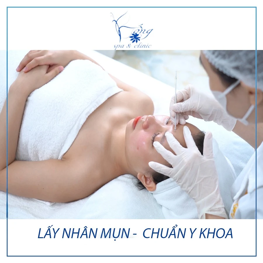 Bống Spa & Clinic - Địa chỉ spa trị mụn lưng uy tín tại TP Hồ Chí Minh