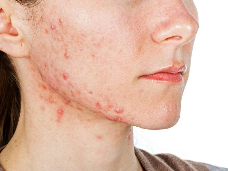 Mỹ phẩm “rởm” hậu quả “thật”