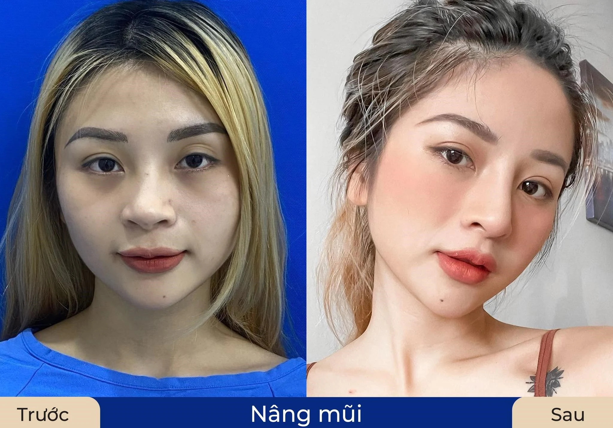 Viện thẩm mỹ Kangnam Thanh Hóa khẳng định uy tín trong ngành thẩm mỹ