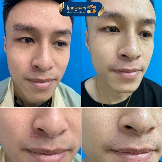 Viện thẩm mỹ Kangnam Thanh Hóa khẳng định uy tín trong ngành thẩm mỹ