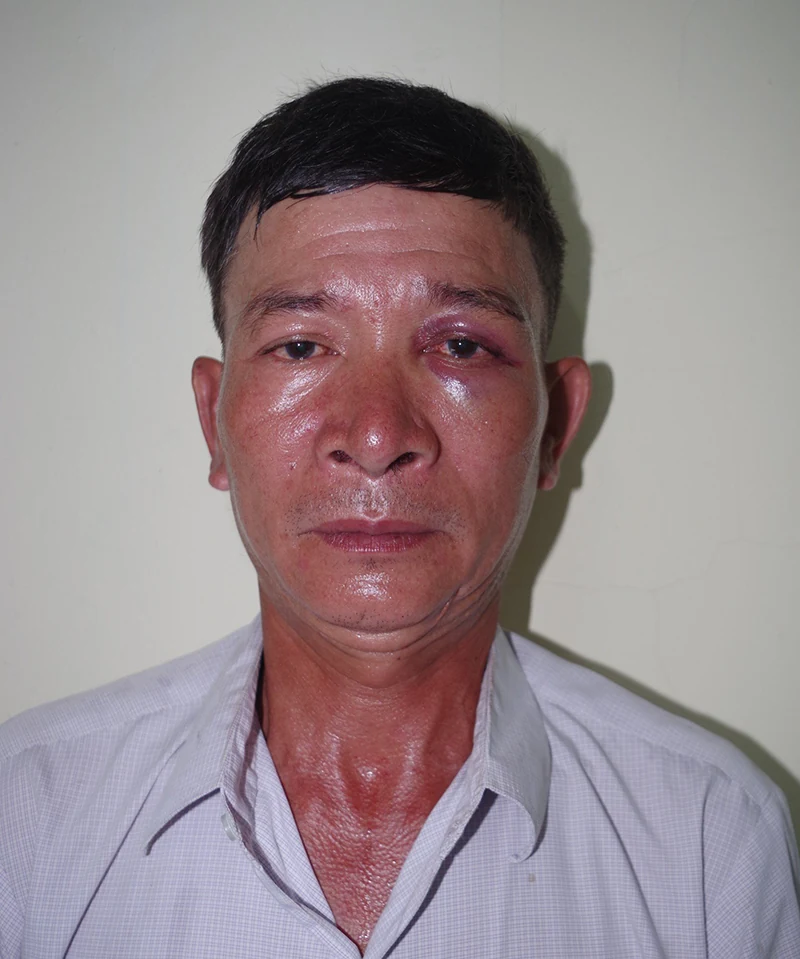 Bắt đối tượng vào nơi trông giữ xe của bệnh viện để lừa đảo