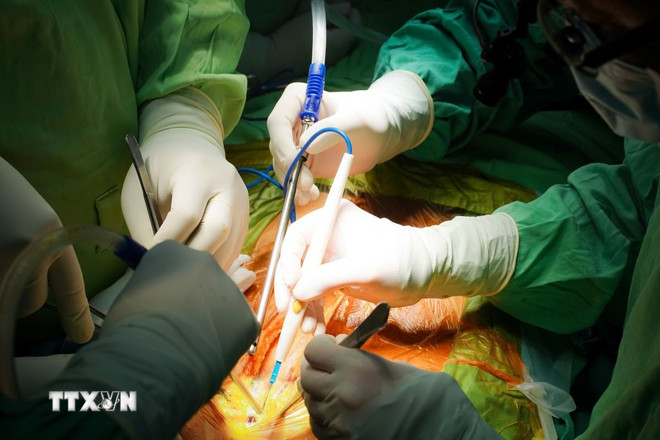TP.HCM: 6 bệnh nhân được cứu sống nhờ ghép tạng