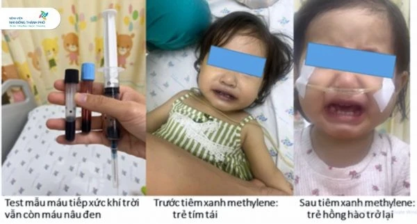 Bác sĩ cảnh báo vì sao nên cẩn trọng khi sử dụng nước giếng để nấu ăn
