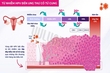 Tin mới cho người nhiễm HPV: Cách đào thải HPV an toàn, kể cả người mang thai