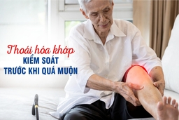 Thoái hóa khớp - Kiểm soát trước khi quá muộn