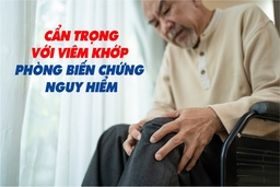 Cẩn trọng với viêm khớp phòng biến chứng nguy hiểm